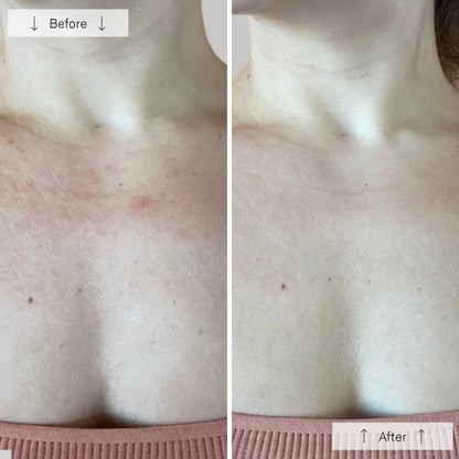 Omnilux Contour Neck & Décolleté